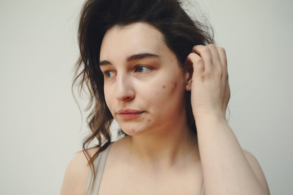 Close-up portrait of a woman with visible acne marks, showcasing natural beauty. - Why You Should Care About Non-Comedogenic Products For The Skin